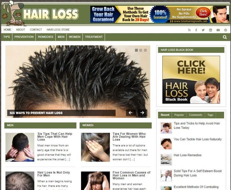 Hair Loss Ready Made Blog Turnkey Niche Website Business for Sale